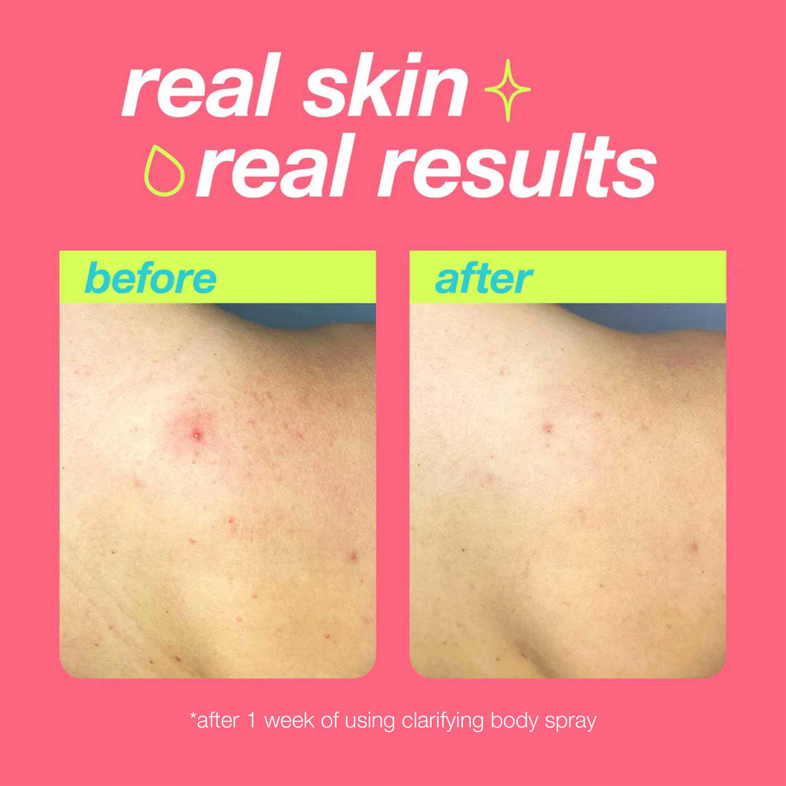 Dermalogica Body Breakout Duo