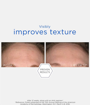 NeoStrata Resurface Smooth Surface Glycolic Peel