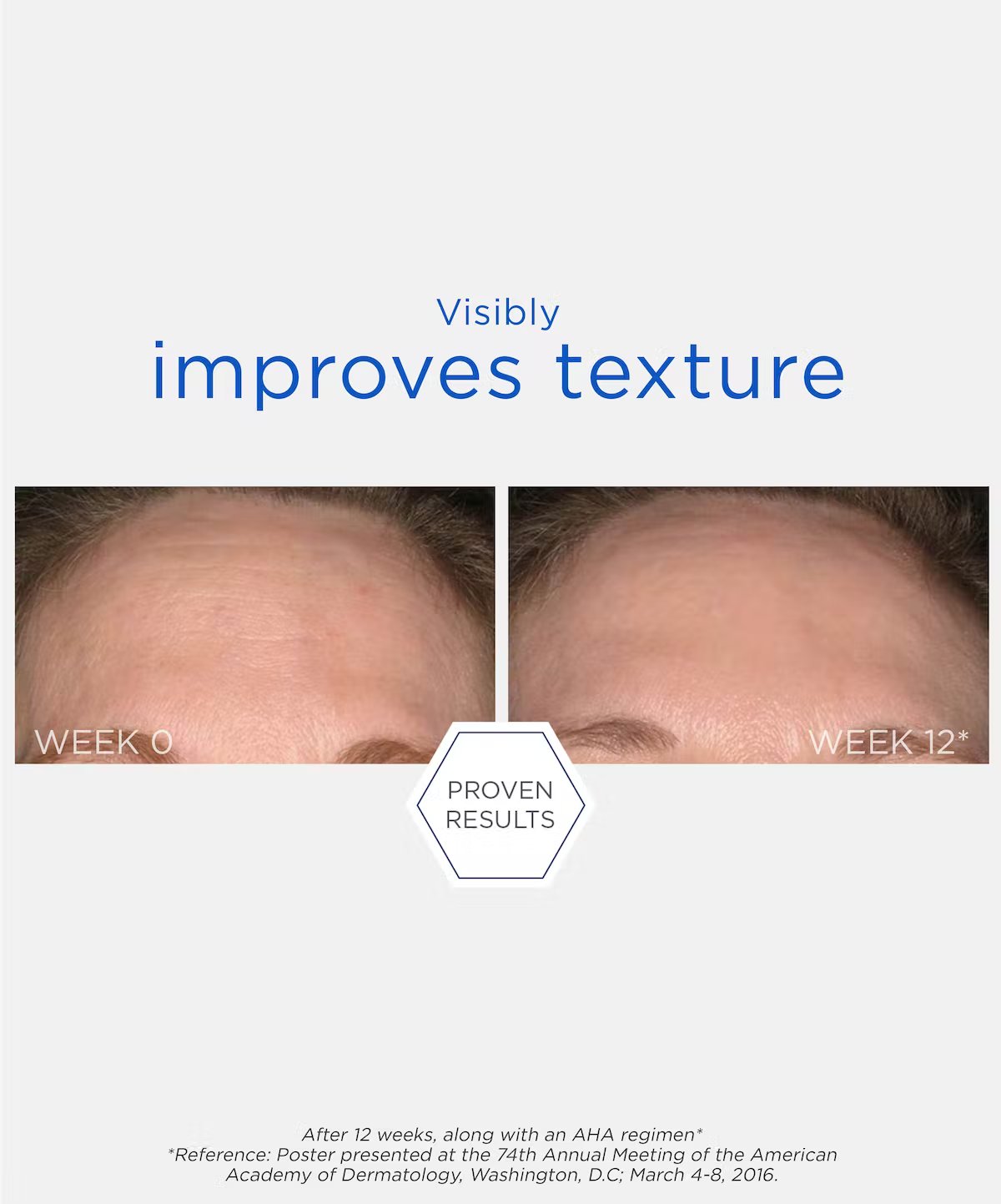 NeoStrata Resurface Smooth Surface Glycolic Peel, view 2