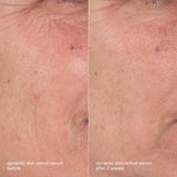 Dermalogica Skin Aging Solutions Kit, view 6