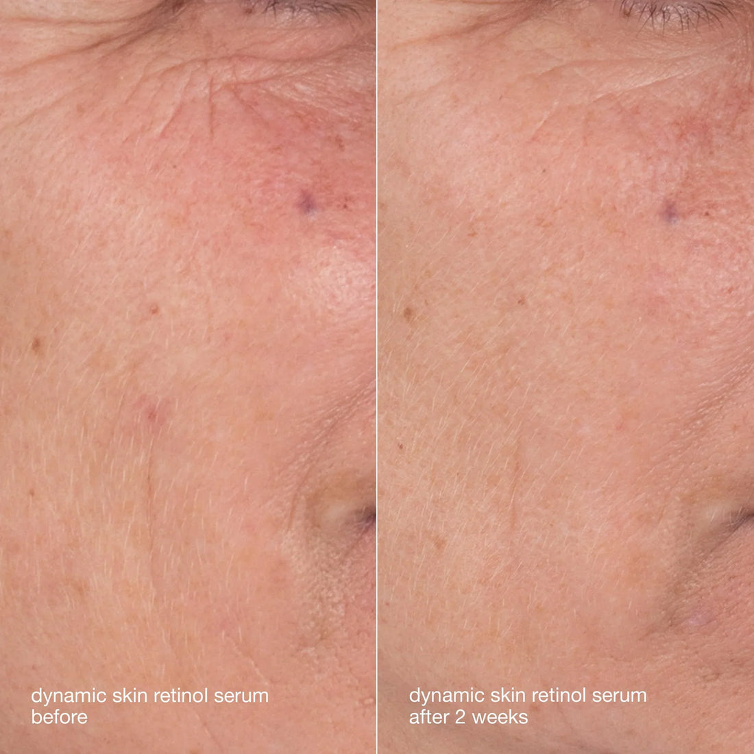 Dermalogica Skin Aging Solutions Kit, view 6