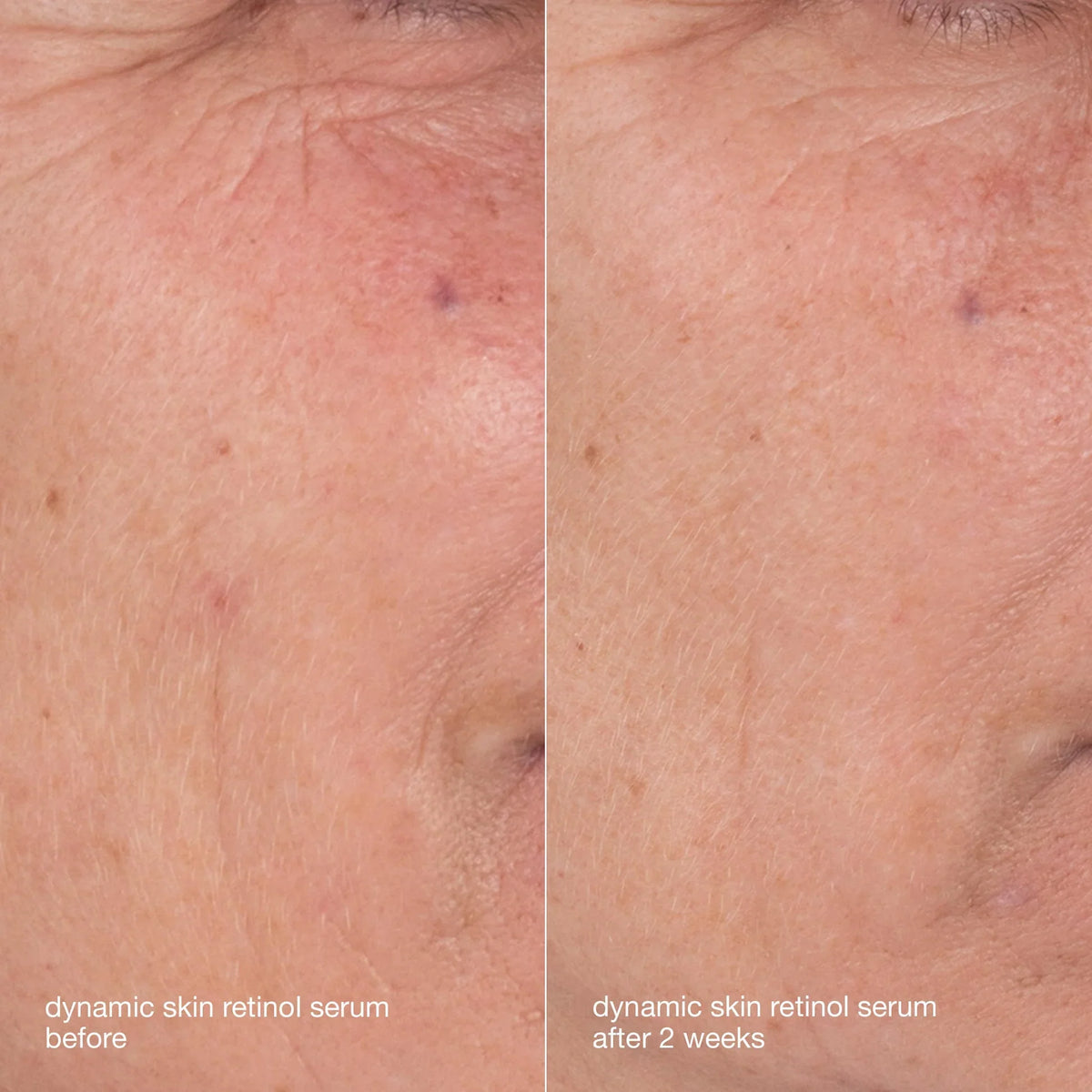 Dermalogica Skin Aging Solutions Kit, view 6